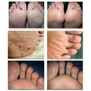 10pcs Ginger Massage Effervescent Tablets Treatment Anti-Swelling Foot SPA