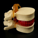 Anatomical Spine Lumbar Disc Herniation Anatomy Medical Teaching Tool