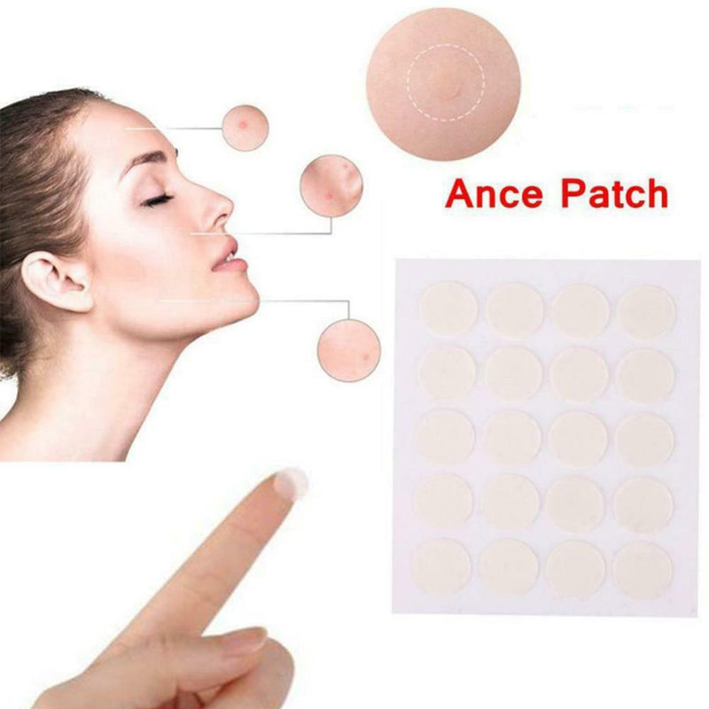 40Pcs Acne Remover Pimple Patch Stickers Tag Removal Facial Spot