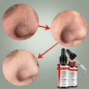 Pore Shrinking Essence Tightening Oil-control Moisturizing HOT Remover Blac O7H4