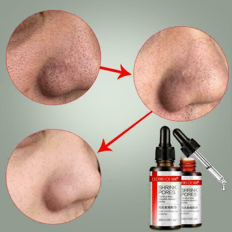 Pore Shrinking Essence Tightening Oil-control Moisturizing HOT Remover Blac O7H4