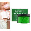 1 Bottle Salicylic Acid Anti-Acne Cotton Pads for Strawberry Nose Acne Marks