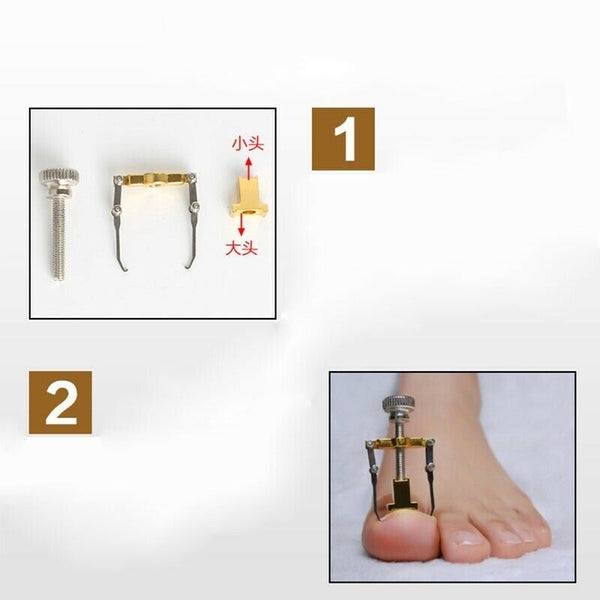 Pro Ingrown Toe Nail Recover Toenail Correction Pedicure Fixer Straightener