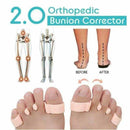 Orthopedic Bunion Corrector Toe Separators Elastic Straighteners Spacers