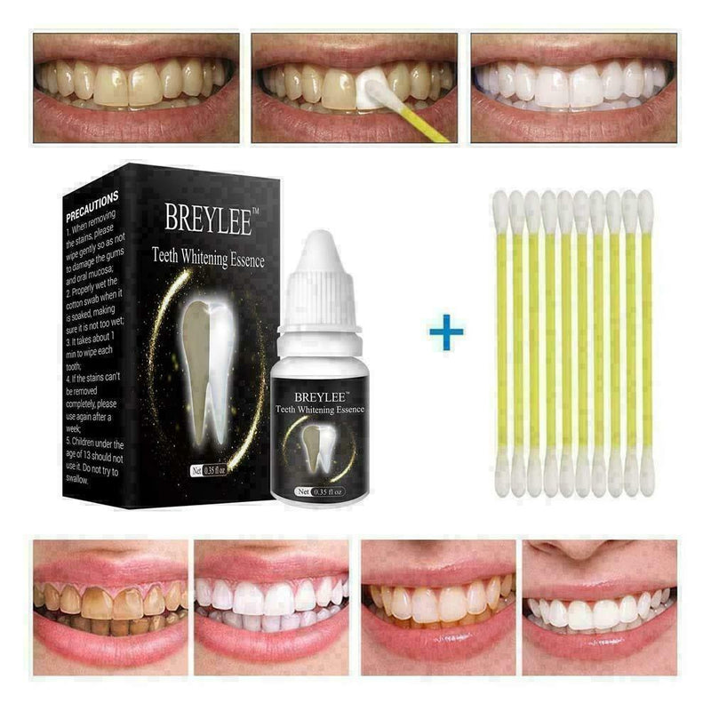 Teeth Whitening Cleaning Teeth Remove Stains/Coffee Stains W6V5 D2X0 Favor H5M2