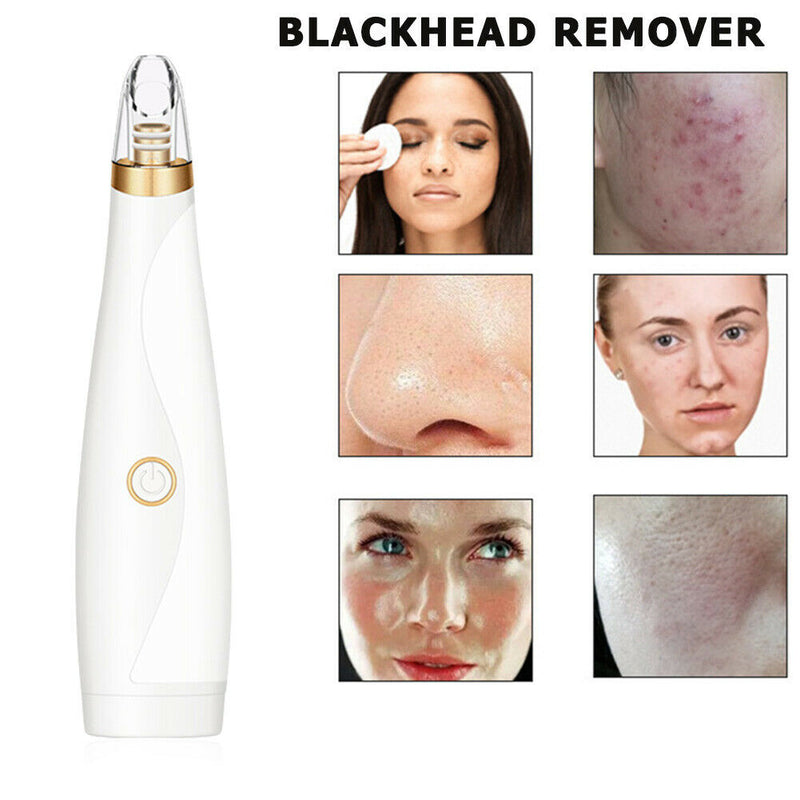 Pore Cleaner Blackhead Remover Vacuum Black Dots Pimples Removal Skin Care