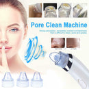 Facial Acne Blackhead Remover Vacuum Suction Pore Clean Machine (White A)