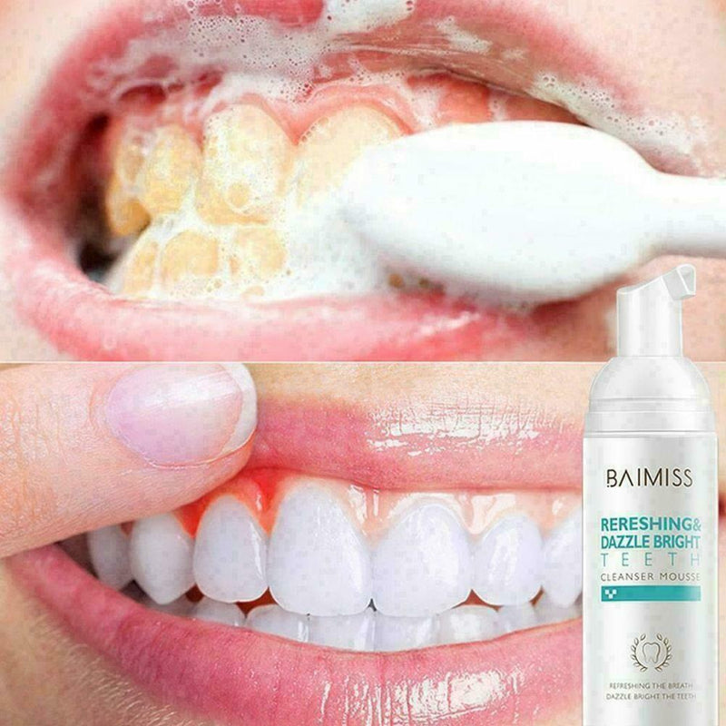 Fresh Shining Tooth-Cleaning Mousse Toothpaste TEETH WHITENING Hygiene NEW U8V1