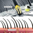 200ml Hair Shampoo Anti hair Loss Herbal Rapid Hair For Men Best Women Grow L5H3