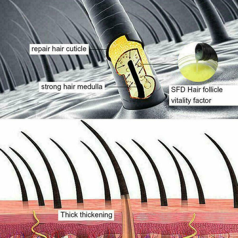 200ml Hair Shampoo Anti hair Loss Herbal Rapid Hair For Men Best Women Grow L5H3