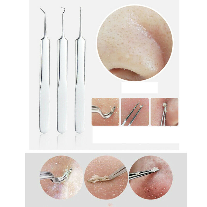 Blackhead Remover Pimple Comedone Extractors Tool Best Acne Removal Kit Treat FT
