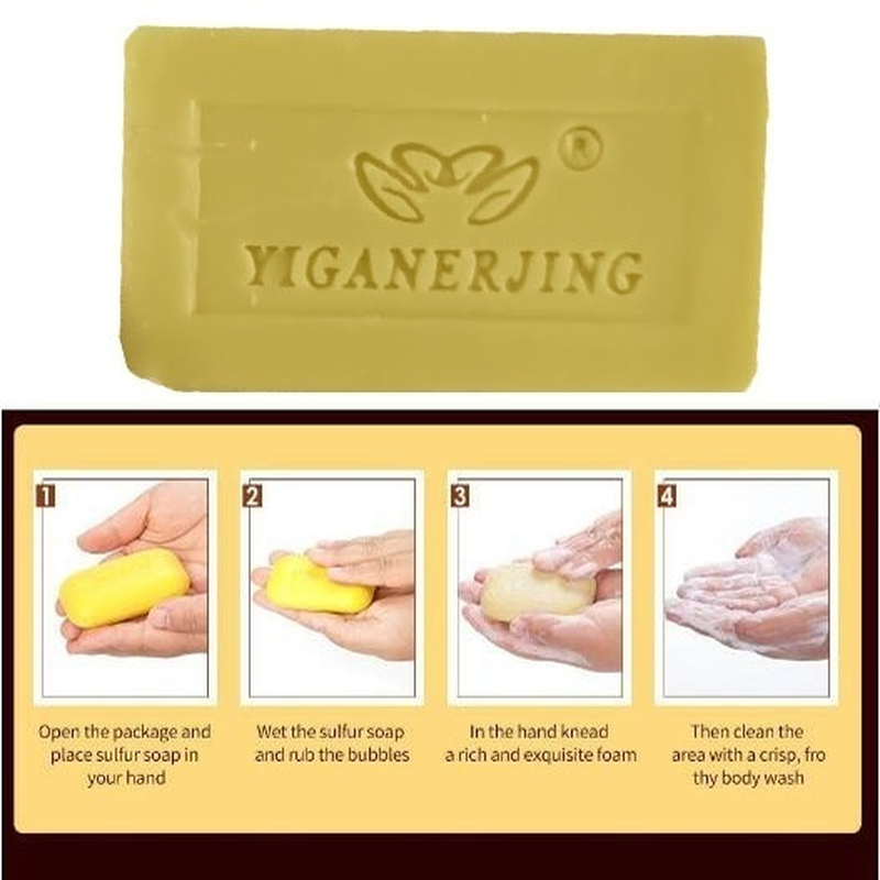 Sulfur Soap Skin Conditions Acne Anti Fungus Handmade Bath Skin Care Shampoo UK