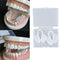 2pcs Dental Mouth Guard Bruxism Splint Teeth Grinding Sleep Aid Braces Tool 3C