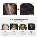 Ginger Fast Hair Growth Essence Essential Oil Anti-Hair Loss Fluid Hair Care