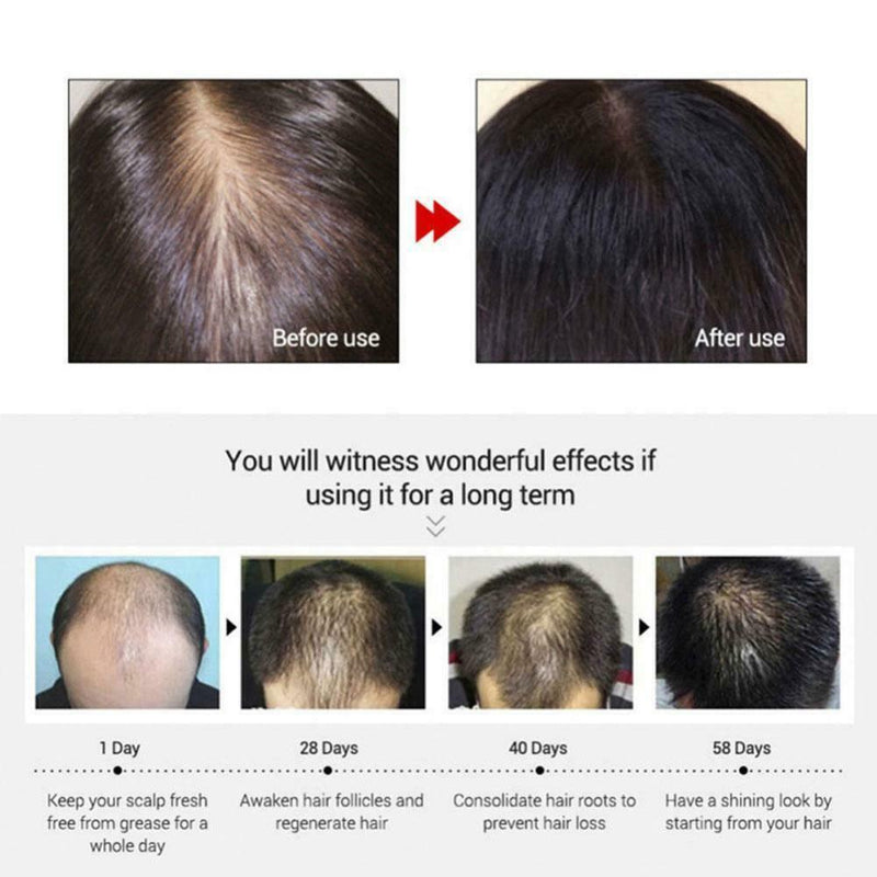 Ginger Fast Hair Growth Essence Essential Oil Anti-Hair Loss Fluid Hair Care