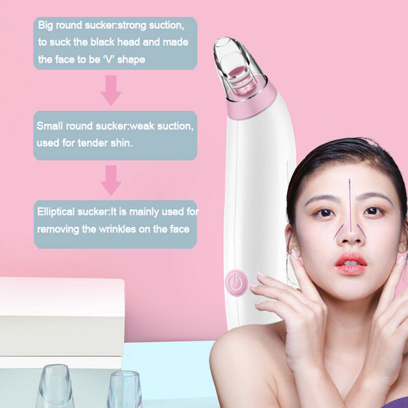 Electric Facial Blackhead Remover Vacuum Suction Skin Nose Pore Cleaner