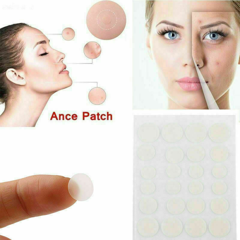36Pcs Skin Tag & Acne Patch - NEW Hydrocolloid Acne & Skin Tag Remover Patches