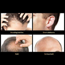 Anti Hair Loss Hair Growth Spray Essential Liquid Dry Regeneration Repair H G7A3