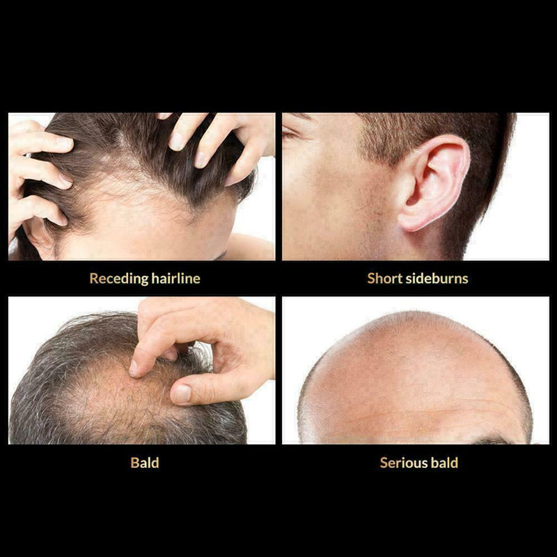 Anti Hair Loss Hair Growth Spray Essential Liquid Dry Regeneration Repair H G7A3