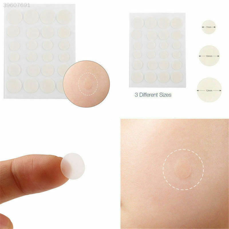 36x Acne Pimple Master Patch Patches Clear Fit Blemish Control Improve Skin KPJ