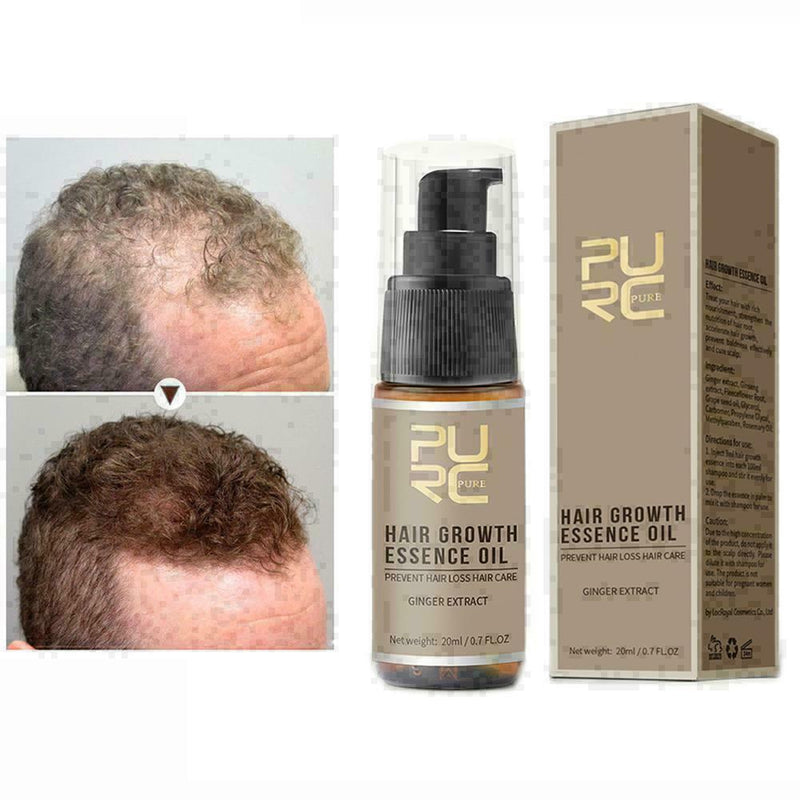 20ml PURC sale Fast Hair Growth Essence Oil Hair Loss K8B8 C Treatment M4Z4 P7R2
