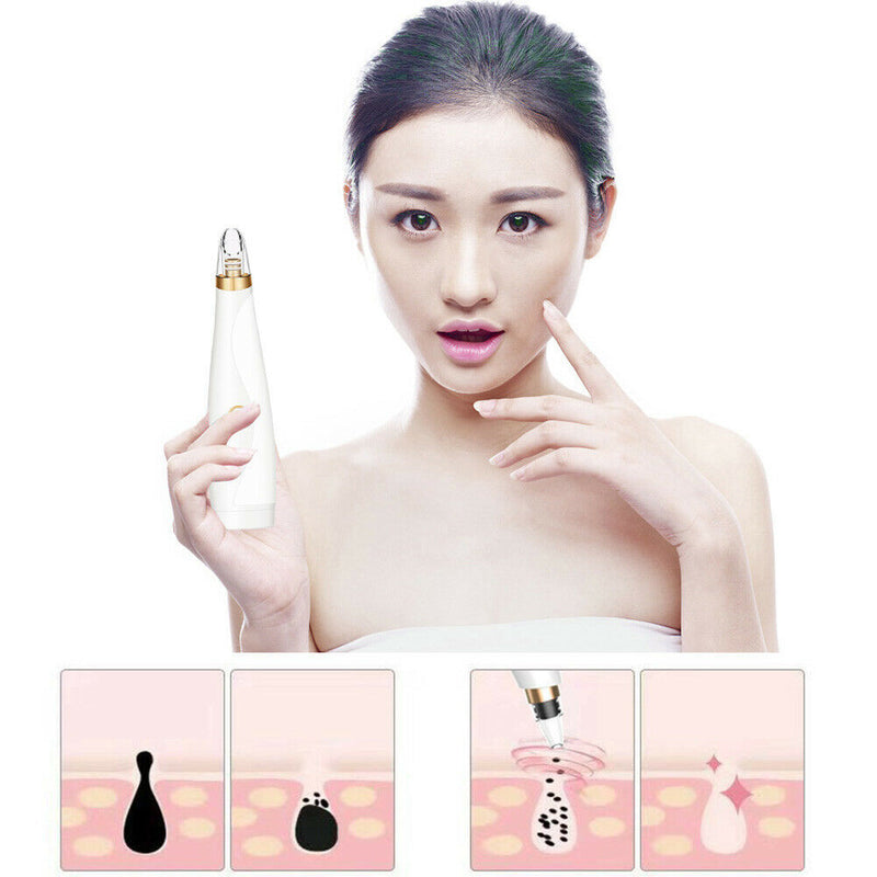 Pore Cleaner Blackhead Remover Vacuum Black Dots Pimples Removal Skin Care