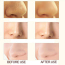 Electric Blackhead Remover Pore Vacuum Suction Diamond Dermabrasion Face C FDZ