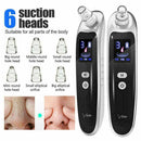 Electric Blackhead Remover Acne Vacuum Cleaner Pore Care Skin Nose Face New I4H7