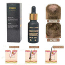 20Ml Natural Hair Growth Serum Essence Oil Hair Fiber Hair best Faster Grow W6S9