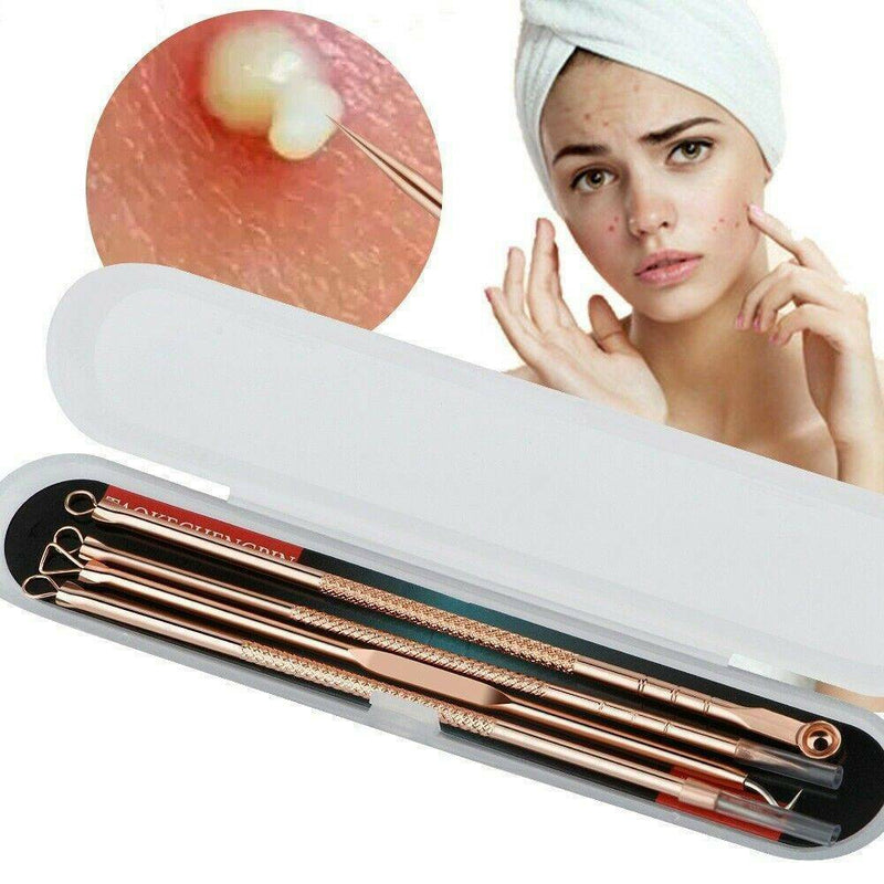 4Pcs Blackhead Whitehead Pimple Spot Comedone Extractor Remover Popper Tools Kit