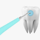 Portable Electric Sonic Dental Scaler Tooth Calculus Removal Teeth Stains T