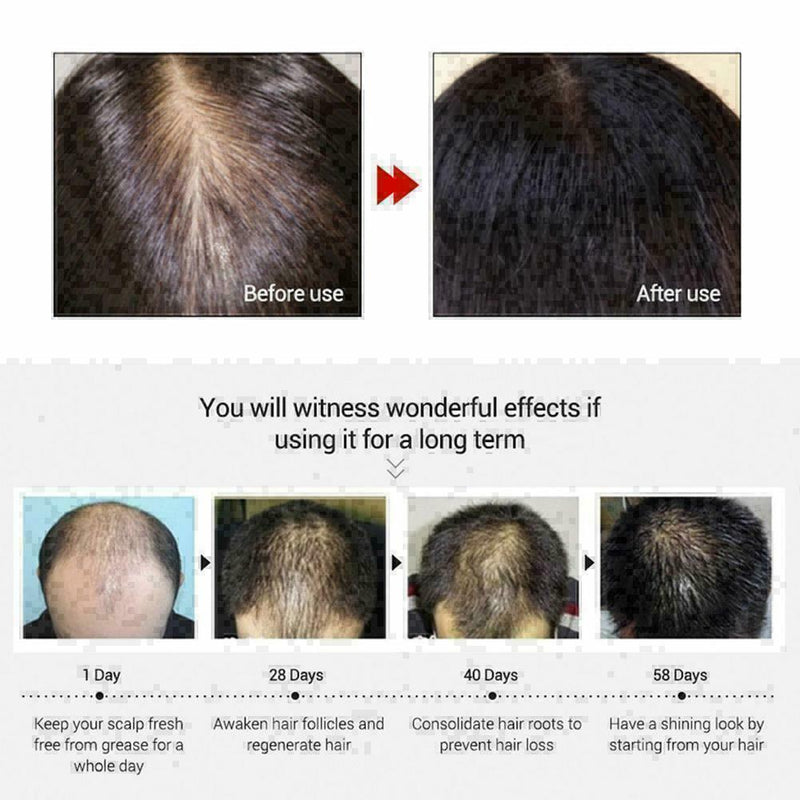 Hair Growth EssenceAndrea Liquid Oil Natural Organic Regrowth Treatment Sup T8Z6