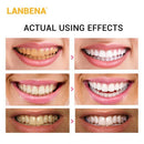 Lanbena Daily Bamboo Charcoal Repair Whitening Teeth Tooth Tooth Removal To