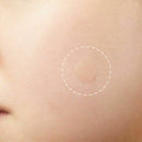40 Pcs Acne Pimple Patch Remover Treatments Blemish Acne Scar Remover Stick D4H4