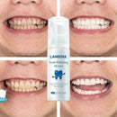 Teeth Whitening Mousse Tooth Whitening Dental Tool Teeth White Hot Cleaning M4X8