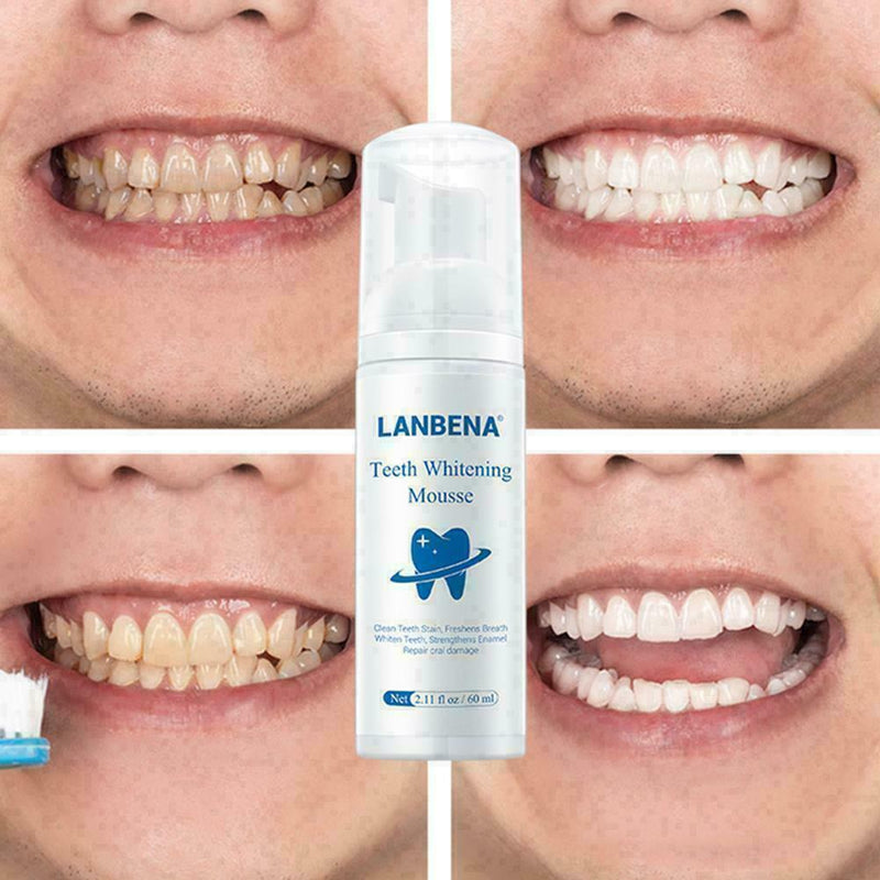 Teeth Whitening Mousse Tooth Whitening Dental Tool Teeth White Hot Cleaning M4X8