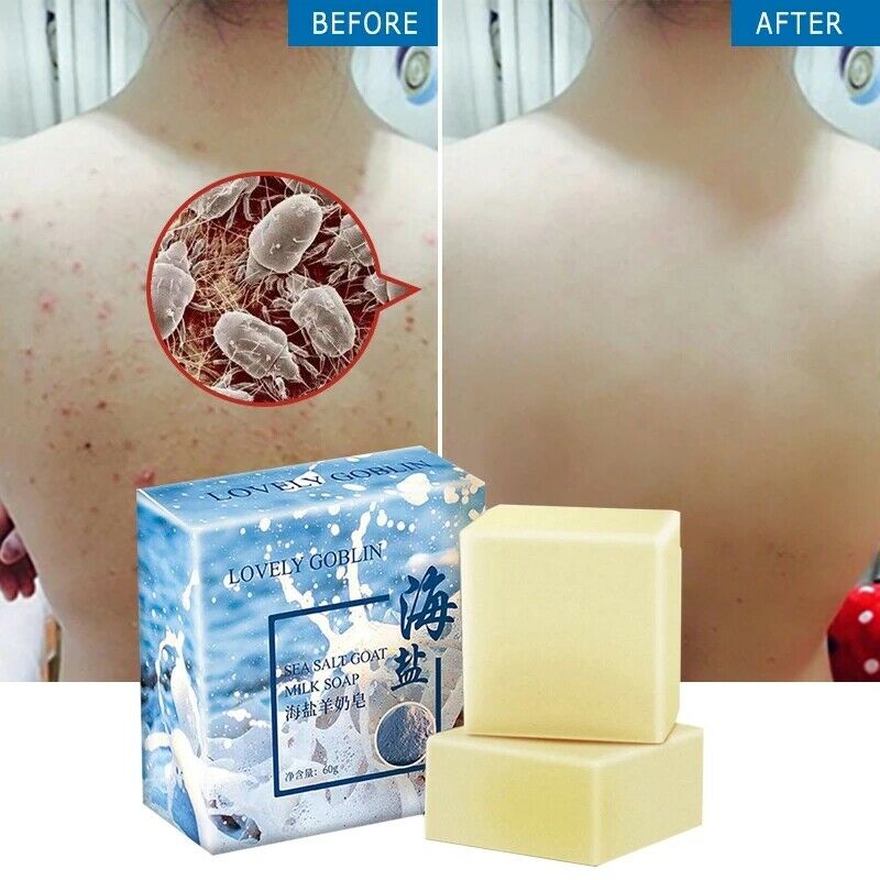 Sea Salt Soap Removal Pimple Pore Acne Treatment Goat Milk Soap Ew