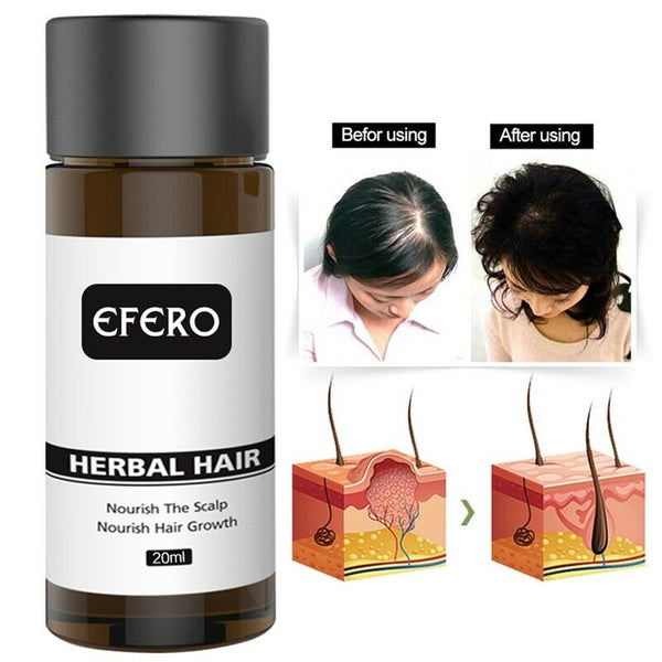 Efero Hair Growth Serum Oil Natural Essence Beard Growth Serum Faster Grow  C5W9