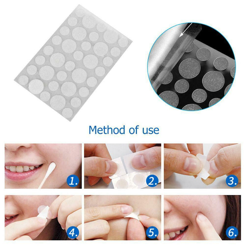 36pcs/bag Acne Pimple Master Patches Face Spot Scar Care Treatment Stickers