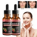 Skin Whitening Oil Brightening Dark Spot Removal 30ml Quality Essence Care V6S1