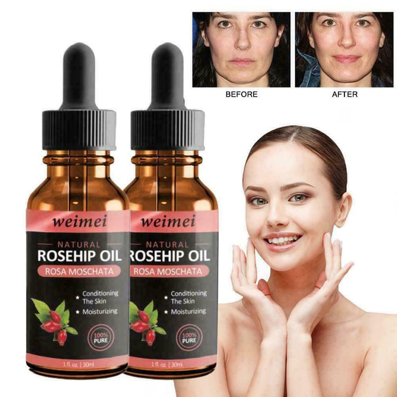 Skin Whitening Oil Brightening Dark Spot Removal 30ml Quality Essence Care V6S1