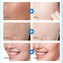 Daralis Face Exfoliating Mousse Shrink Pores Removal Blackhead Skin Care Fo Y8E4