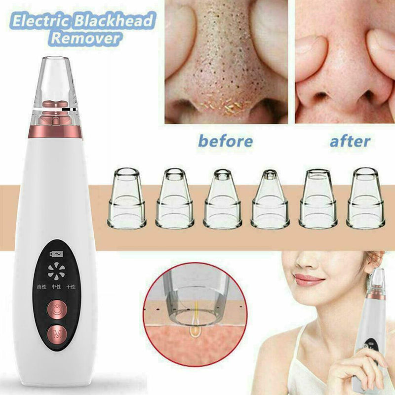 Blackhead Remover Vacuum Extractor Pro Suction Facial Acne Pore Effectiv Cl Q2X4