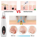 Blackhead Remover Vacuum Extractor Pro Suction Facial Acne Pore Effectiv Cl Q2X4