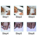 5x Fixer Pedicure Recover Toe Nail Foot Care Nail Correction File CorrectorG %ã€Š