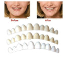 Tooth Kit DELUXE 3 SHADES of Temporary Teeth Included Super C3O5 K0R8 S8J7