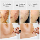 Vibrant Glamour Crocodile Repair Scar Face Serum Removal Acne Scar Whitenin O7E4