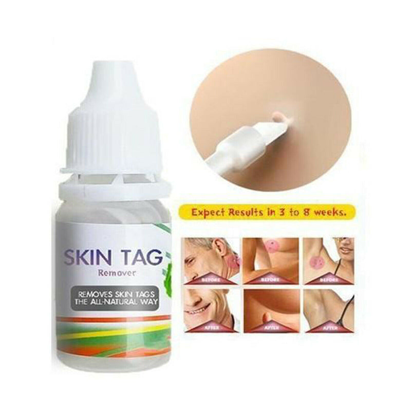 Skin Tag Removal, All Natural, Home Skin Care, Remove Skin Tag Efficiently, Best
