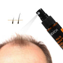 30ml Hair Growth Spray Hair Loss Aid Strong Hair Hair Care for Men and Women