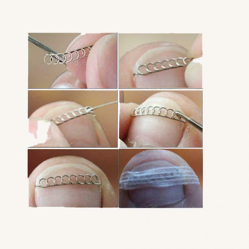 Waxed Toenail Corrector 3 Pieces Foot Care Tools Accessories